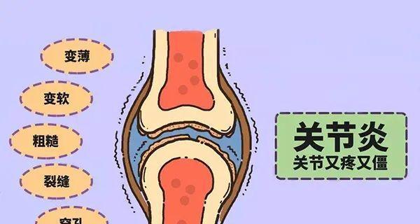 银狐犬为什么易得关节炎？（探究银狐犬关节炎的成因及预防方法）
