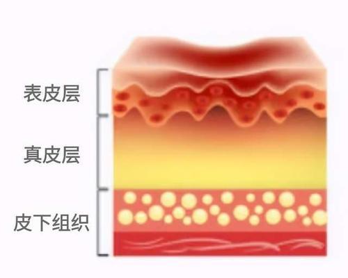 宠物烧伤烫伤后的急救与护理方法（京巴宝宝烧伤烫伤常见原因及处理方式）