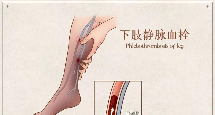 宠物犬京巴常见病的预防知识（为爱宠定制的健康方案，从预防开始）