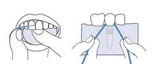 如何护理凯利蓝梗的牙齿（从宠物主人的角度出发，让凯利蓝梗的牙齿健康无忧）
