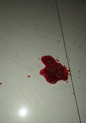 狗狗拉血过多的原因及治疗方法（宠物主人必知！如何保护狗狗的健康）
