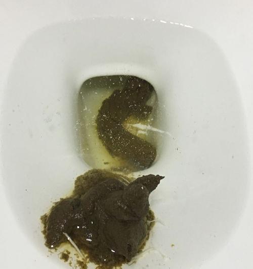 小狗的粪便带虫（如何识别和预防小狗拉出来的虫子）