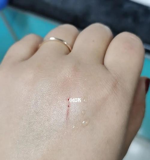 被猫抓伤会有什么危害？需要采取哪些预防措施？