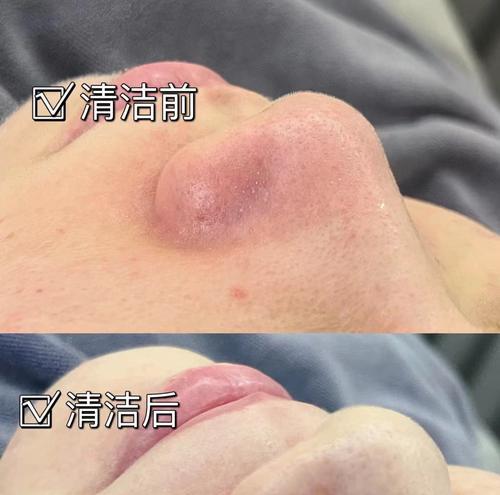 清道夫不干活怎么办？怎么激励它们清洁？