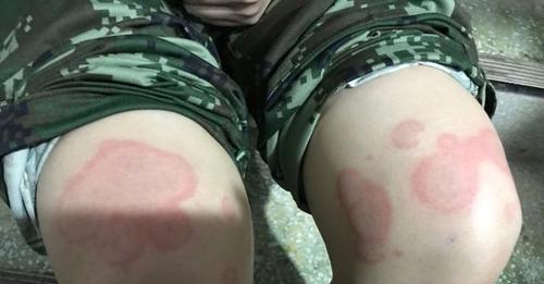 手被幼犬咬破了怎么办？紧急处理和预防措施是什么？