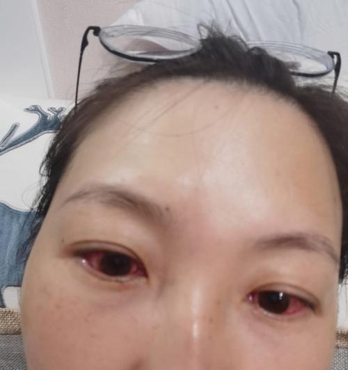 泰迪犬结膜炎怎么治？有效治疗方法有哪些？