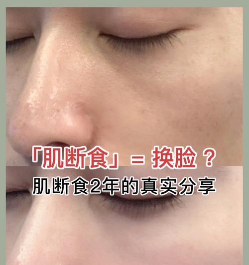 比熊犬过量进食后是否需要断食？断食对狗狗健康的影响如何？