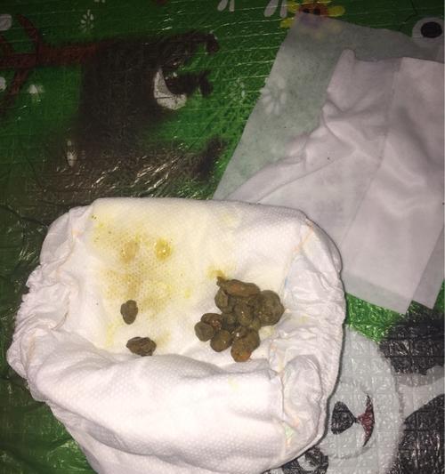 小孩子拉羊驼屎应该怎么办？需要吃什么药？