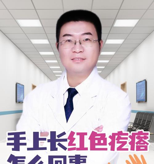 接触羊驼后手部过敏怎么办？有哪些预防措施？