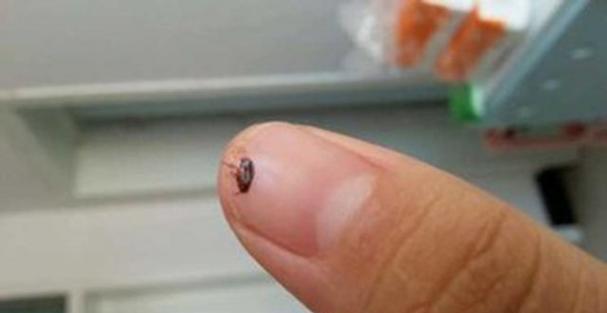 猫粮中的跳蚤如何彻底清除？有效预防方法有哪些？